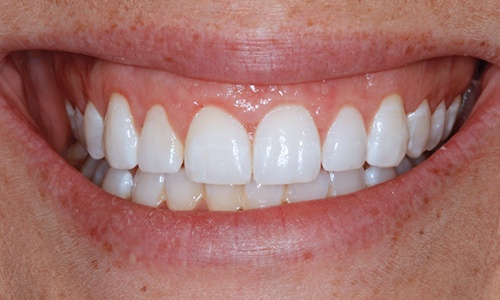 smile gallery image