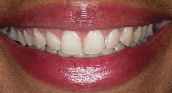 Ayanna After