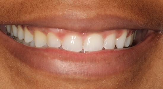 Ayanna Before