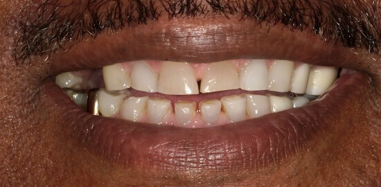 Jerome Before