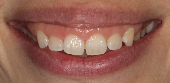 Sehar Before