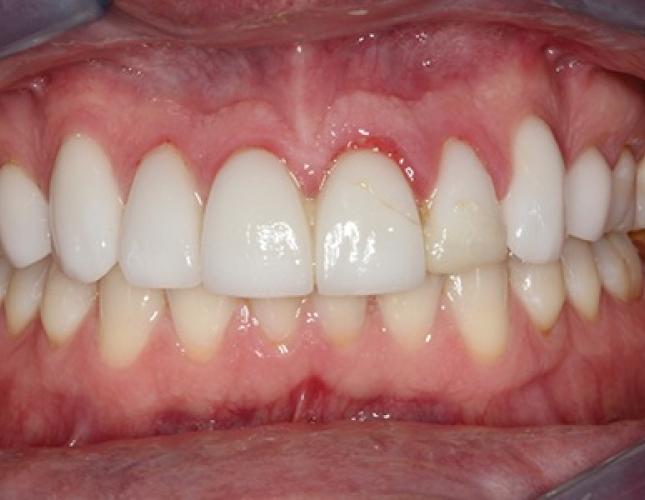 case1-b1