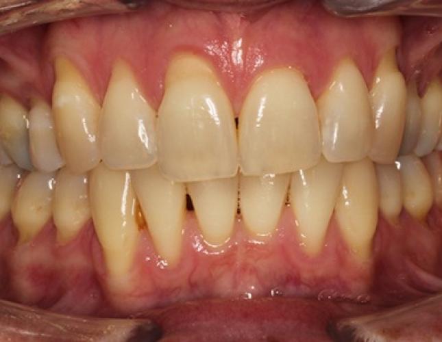 case4-b1