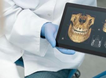 Dental Cone Beam CT Scans: When 3D Imaging is Necessary