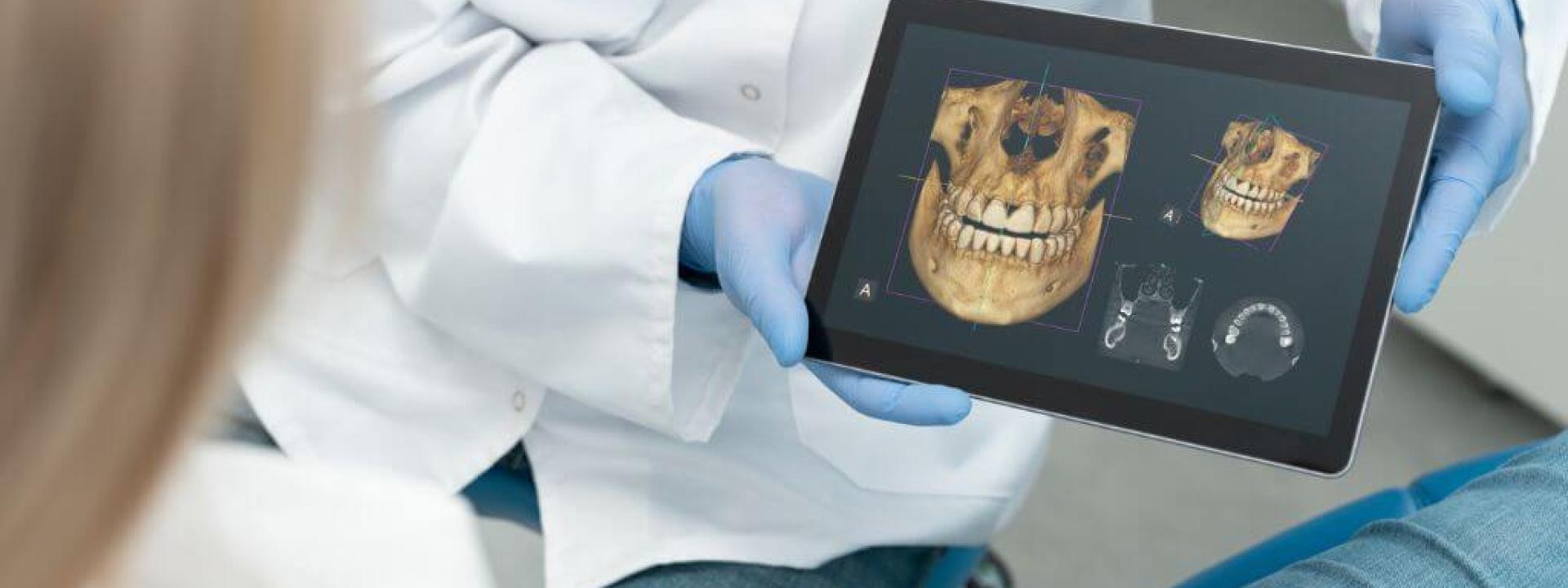 Dental Cone