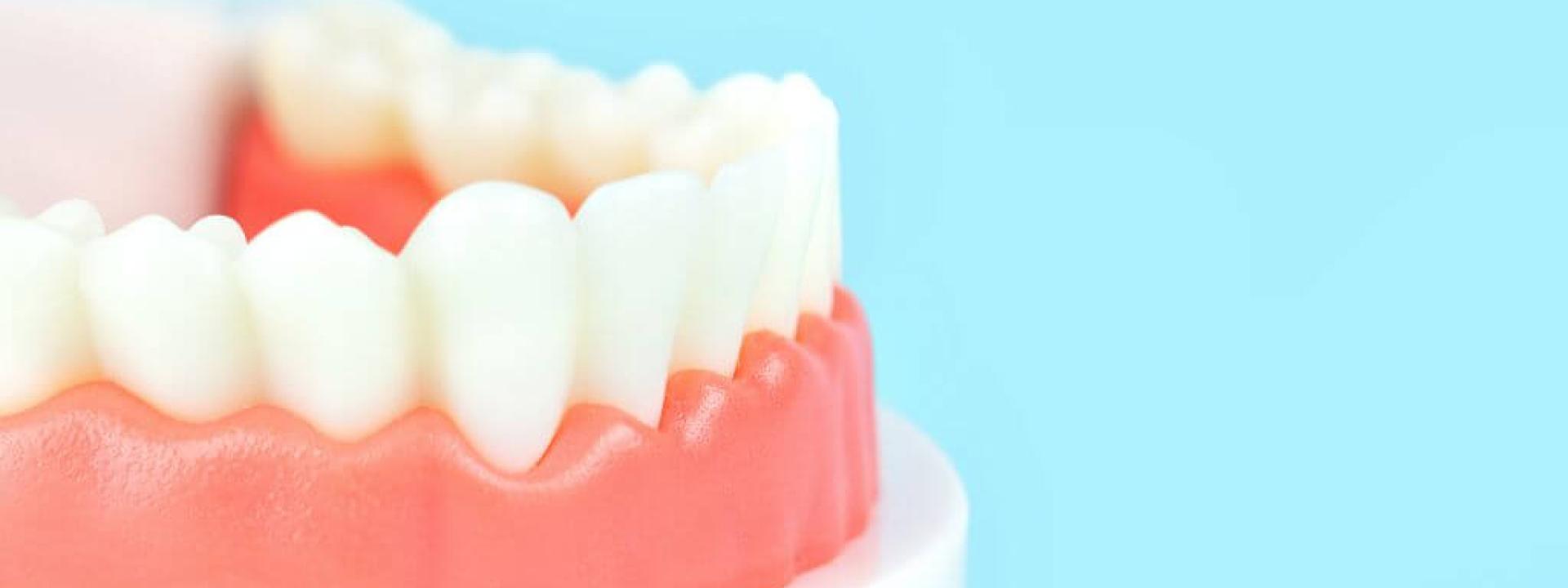 Dental prototype to show gum health.